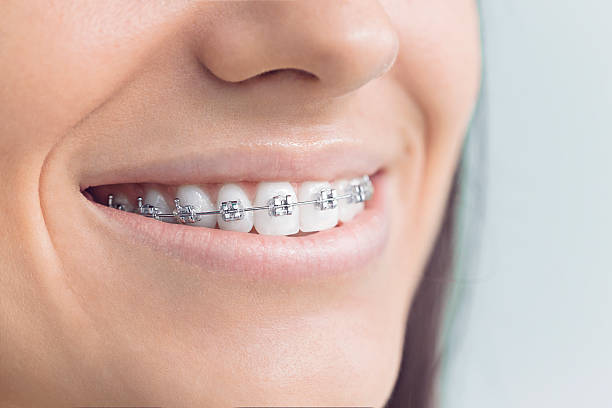 Best Invisalign and Clear Aligners  in North Hills, NY